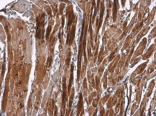 alpha Actinin 2 Antibody in Immunohistochemistry (Paraffin) (IHC (P))