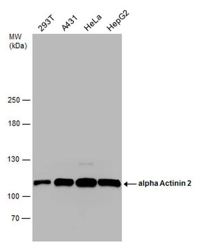 alpha Actinin 2 Antibody in Western Blot (WB)