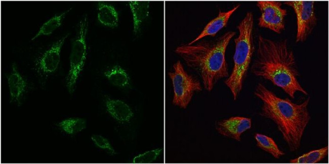 TFAM Antibody in Immunocytochemistry (ICC/IF)