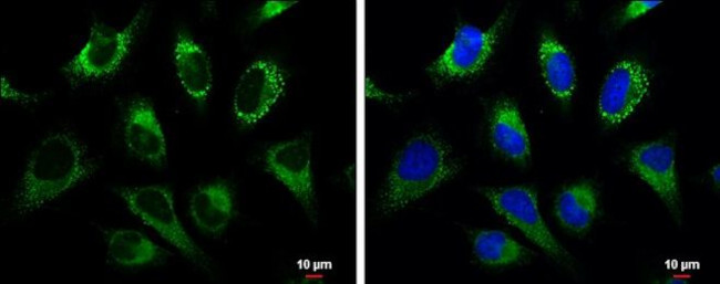 GRP94 Antibody in Immunocytochemistry (ICC/IF)