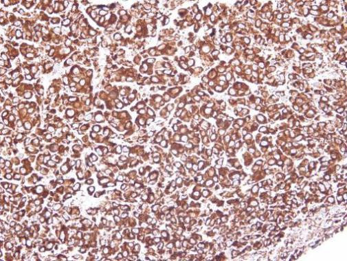 GRP94 Antibody in Immunohistochemistry (Paraffin) (IHC (P))