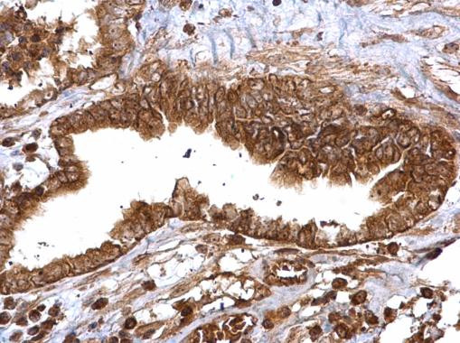 Thymidylate Synthase Antibody in Immunohistochemistry (Paraffin) (IHC (P))