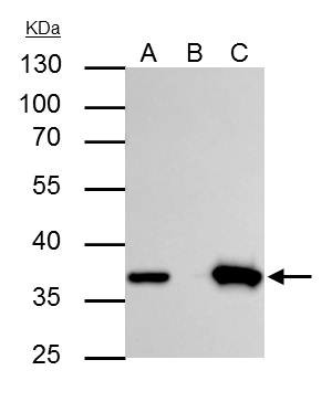 Thymidylate Synthase Antibody in Immunoprecipitation (IP)