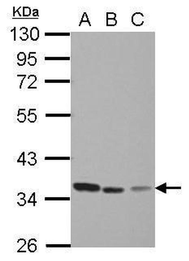 Thymidylate Synthase Antibody in Western Blot (WB)