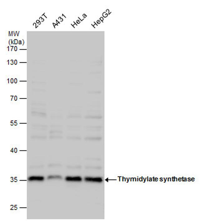 Thymidylate Synthase Antibody in Western Blot (WB)