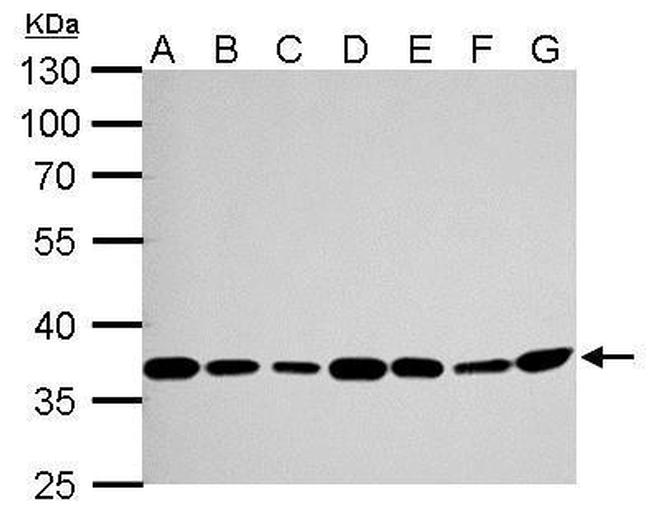 Thymidylate Synthase Antibody in Western Blot (WB)