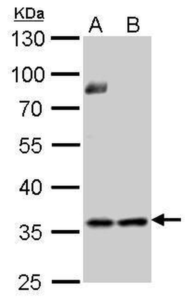 Thymidylate Synthase Antibody in Western Blot (WB)