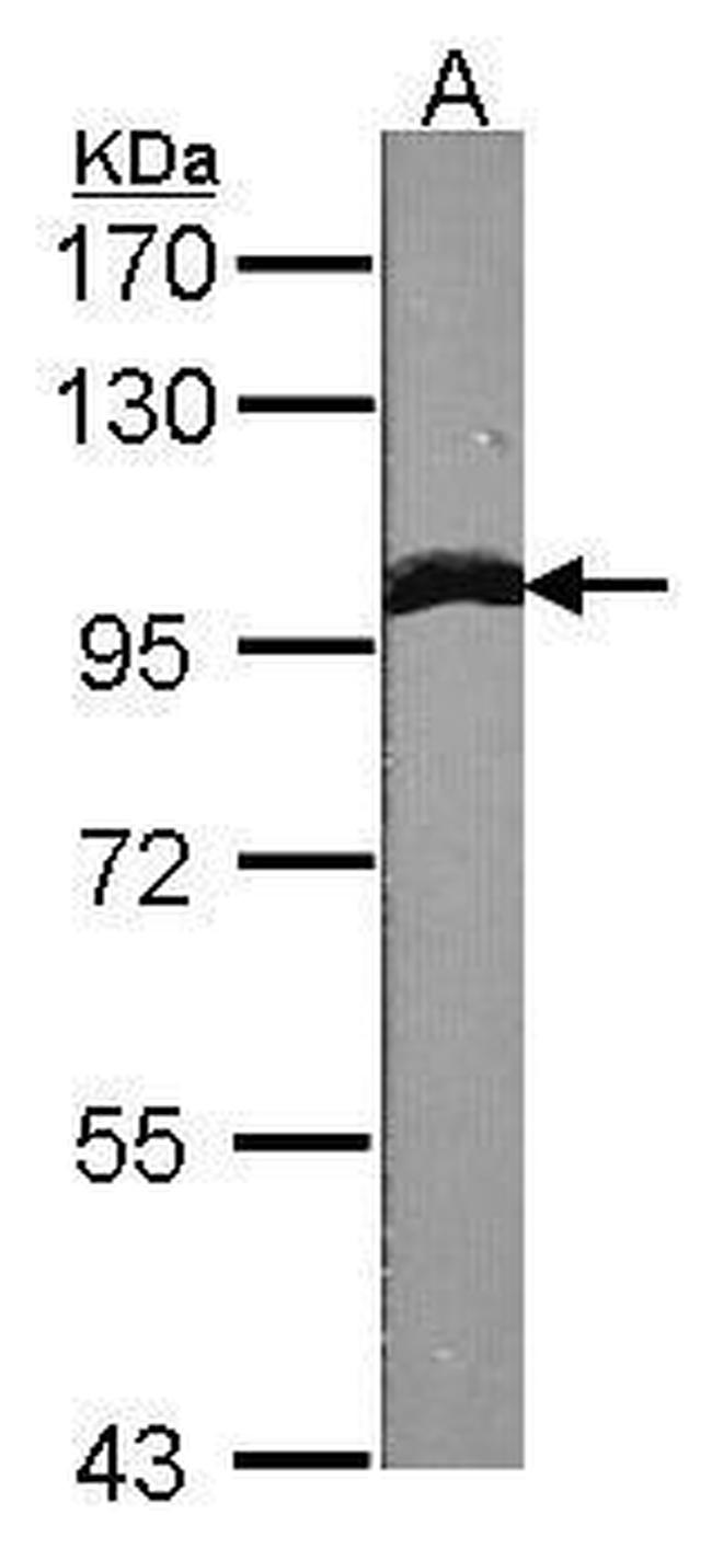 alpha Actinin 1 Antibody in Western Blot (WB)