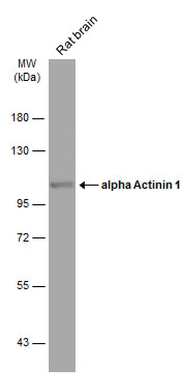 alpha Actinin 1 Antibody in Western Blot (WB)