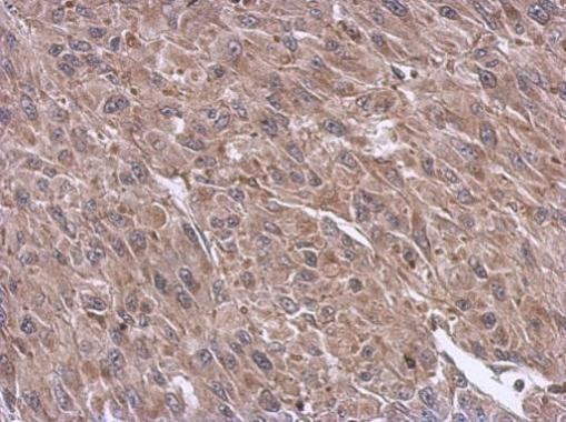 GPNMB Antibody in Immunohistochemistry (Paraffin) (IHC (P))