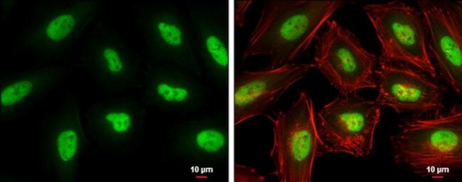 KLF5 Antibody in Immunocytochemistry (ICC/IF)