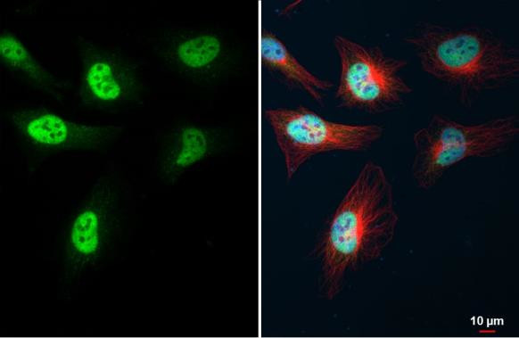 KLF5 Antibody in Immunocytochemistry (ICC/IF)