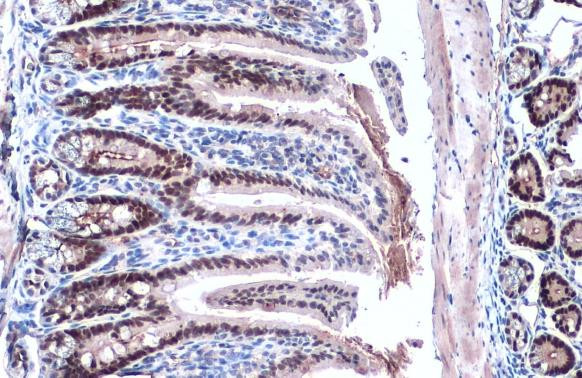 KLF5 Antibody in Immunohistochemistry (Paraffin) (IHC (P))