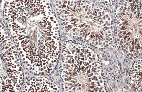 KLF5 Antibody in Immunohistochemistry (Paraffin) (IHC (P))