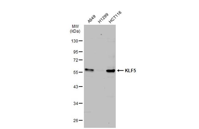 KLF5 Antibody in Western Blot (WB)