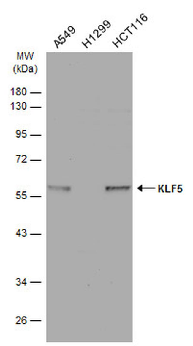 KLF5 Antibody in Western Blot (WB)