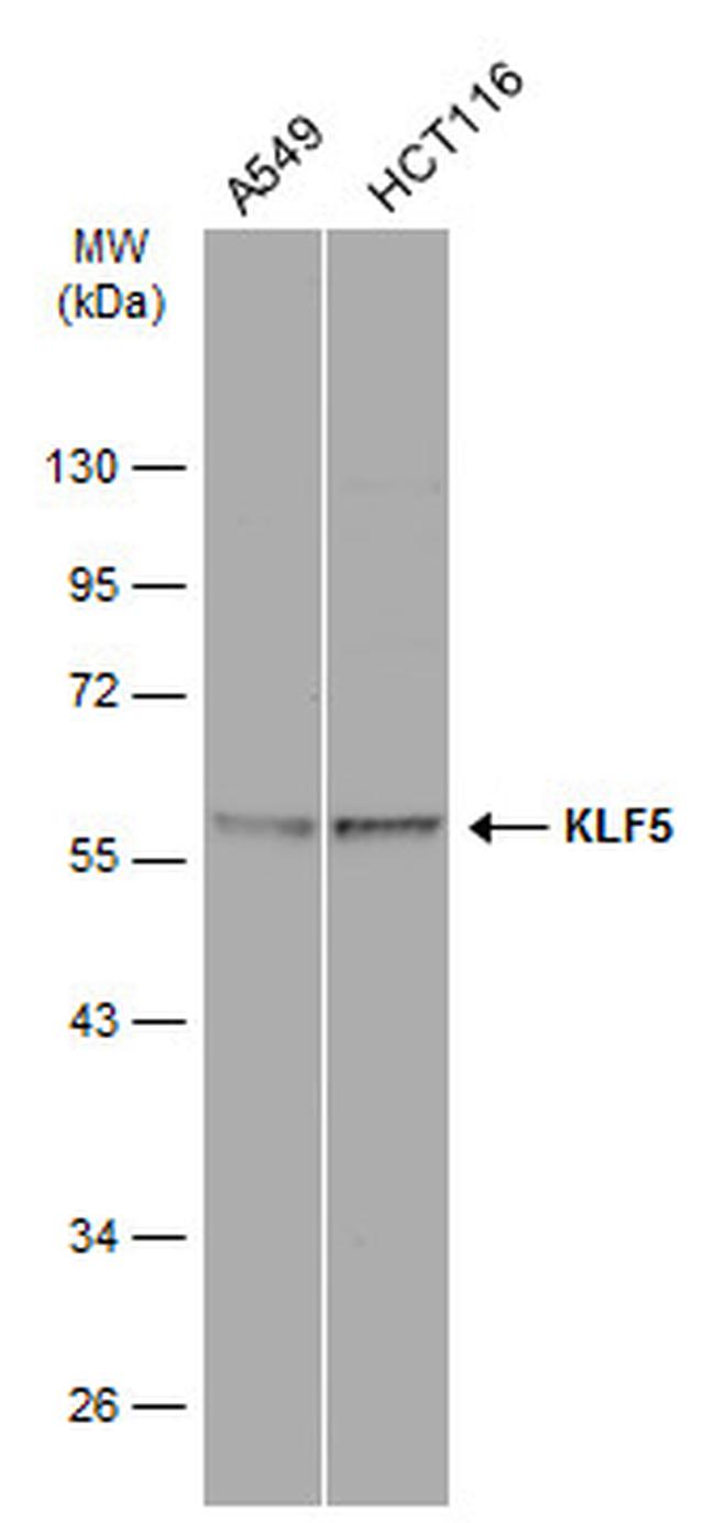 KLF5 Antibody in Western Blot (WB)