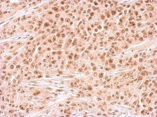 RAD54B Antibody in Immunohistochemistry (Paraffin) (IHC (P))