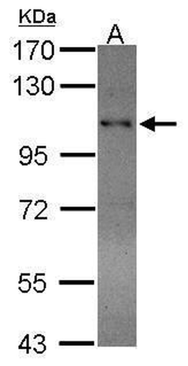 RAD54B Antibody in Western Blot (WB)