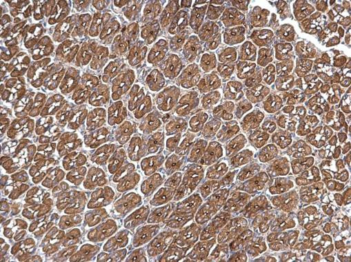 Arp2 Antibody in Immunohistochemistry (Paraffin) (IHC (P))