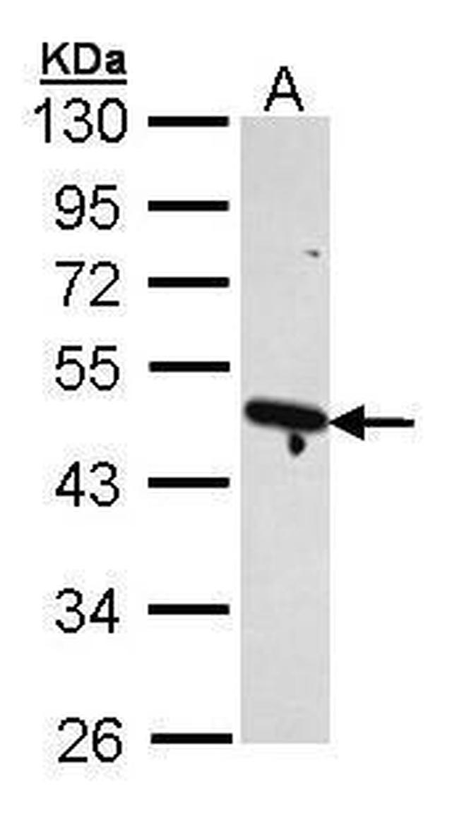 Arp2 Antibody in Western Blot (WB)