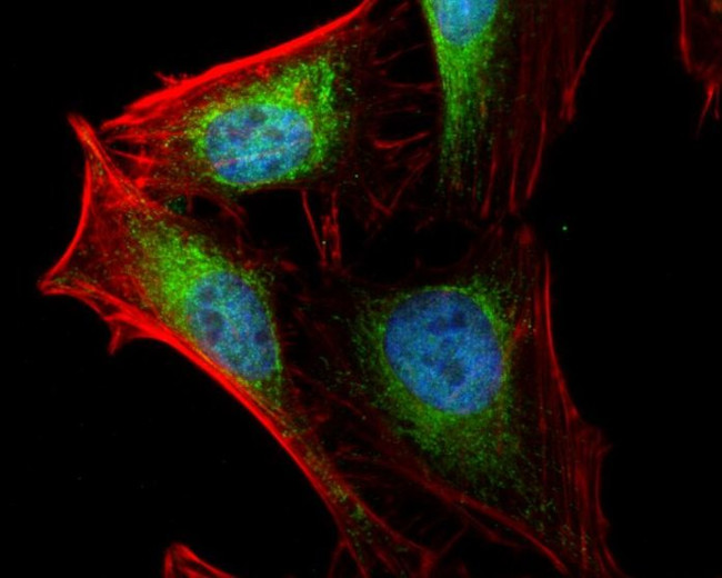 Arp2 Antibody in Immunocytochemistry (ICC/IF)