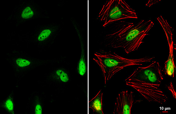 Nrf2 Antibody in Immunocytochemistry (ICC/IF)