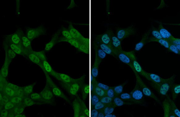 Nrf2 Antibody in Immunocytochemistry (ICC/IF)