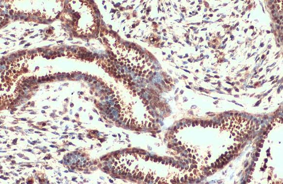 Nrf2 Antibody in Immunohistochemistry (Paraffin) (IHC (P))