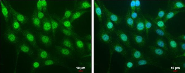 Nrf2 Antibody in Immunocytochemistry (ICC/IF)