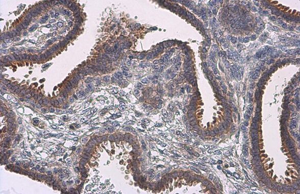 Nrf2 Antibody in Immunohistochemistry (Paraffin) (IHC (P))