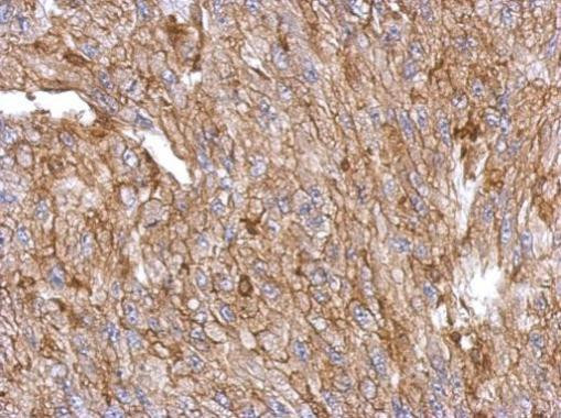 Annexin A3 Antibody in Immunohistochemistry (Paraffin) (IHC (P))