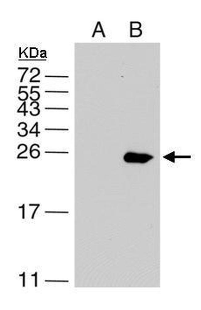 Dengue Virus Type 2 NS4B Antibody in Western Blot (WB)