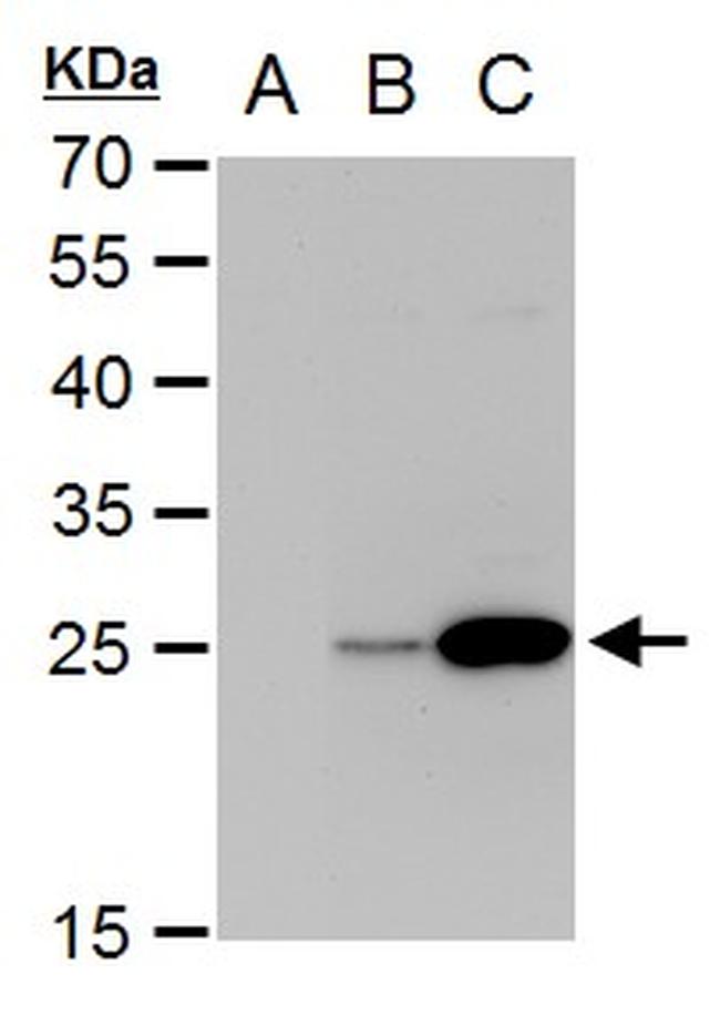 Dengue Virus Type 2 NS4B Antibody in Western Blot (WB)