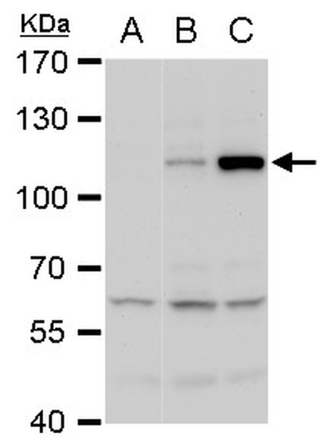 Dengue Virus Type 2 NS5 Antibody in Western Blot (WB)