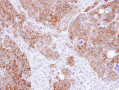 DARS Antibody in Immunohistochemistry (Paraffin) (IHC (P))