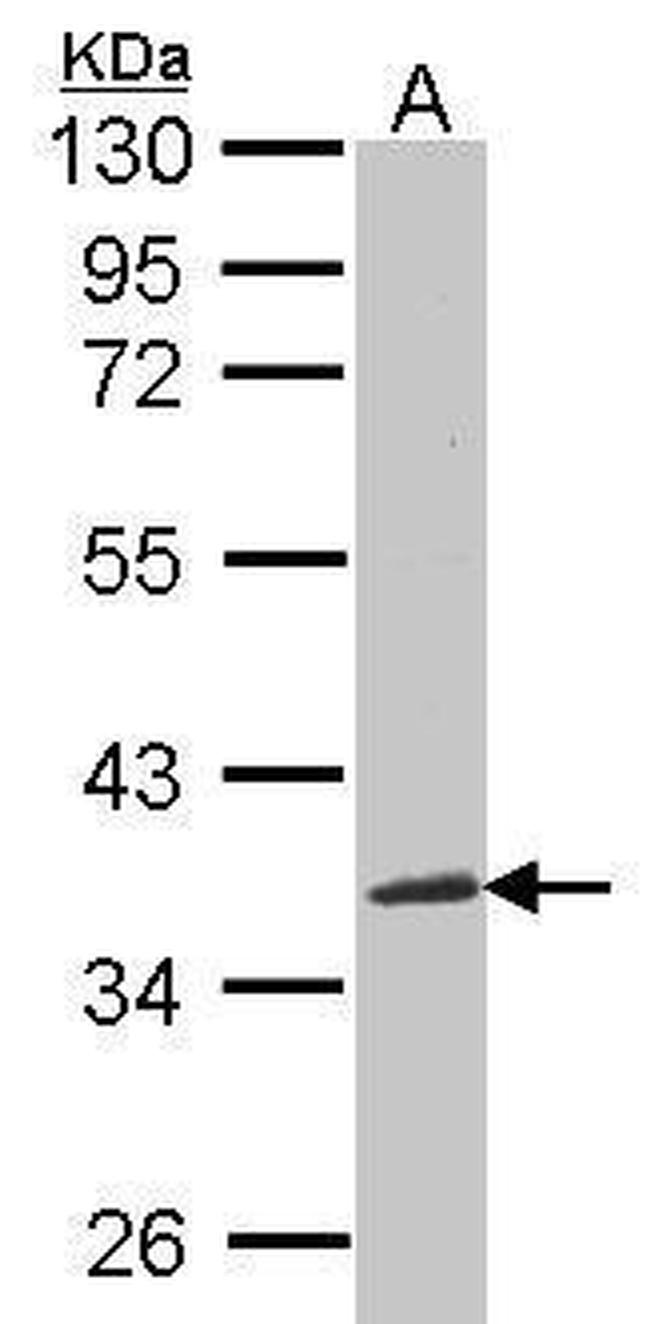 NOV Antibody in Western Blot (WB)