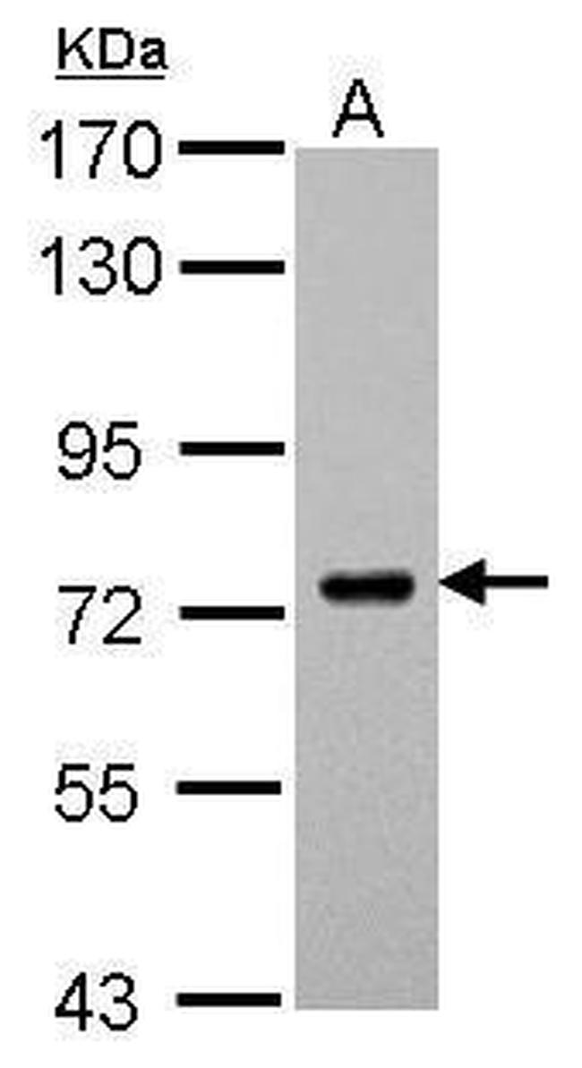 SAMHD1 Antibody in Western Blot (WB)