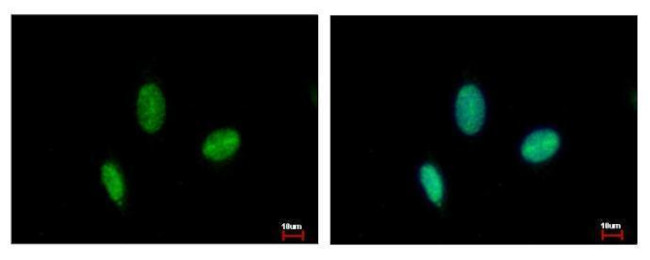 RAD23B Antibody in Immunocytochemistry (ICC/IF)