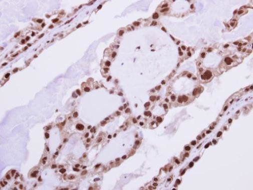 RAD23B Antibody in Immunohistochemistry (Paraffin) (IHC (P))