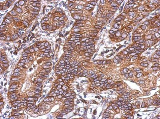 ACVR1C Antibody in Immunohistochemistry (Paraffin) (IHC (P))