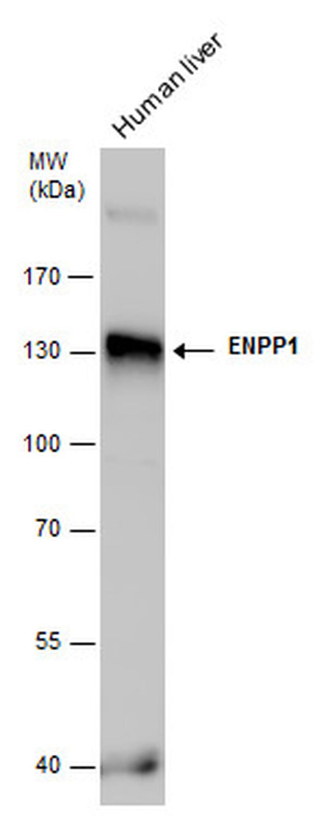 ENPP1 Antibody in Western Blot (WB)