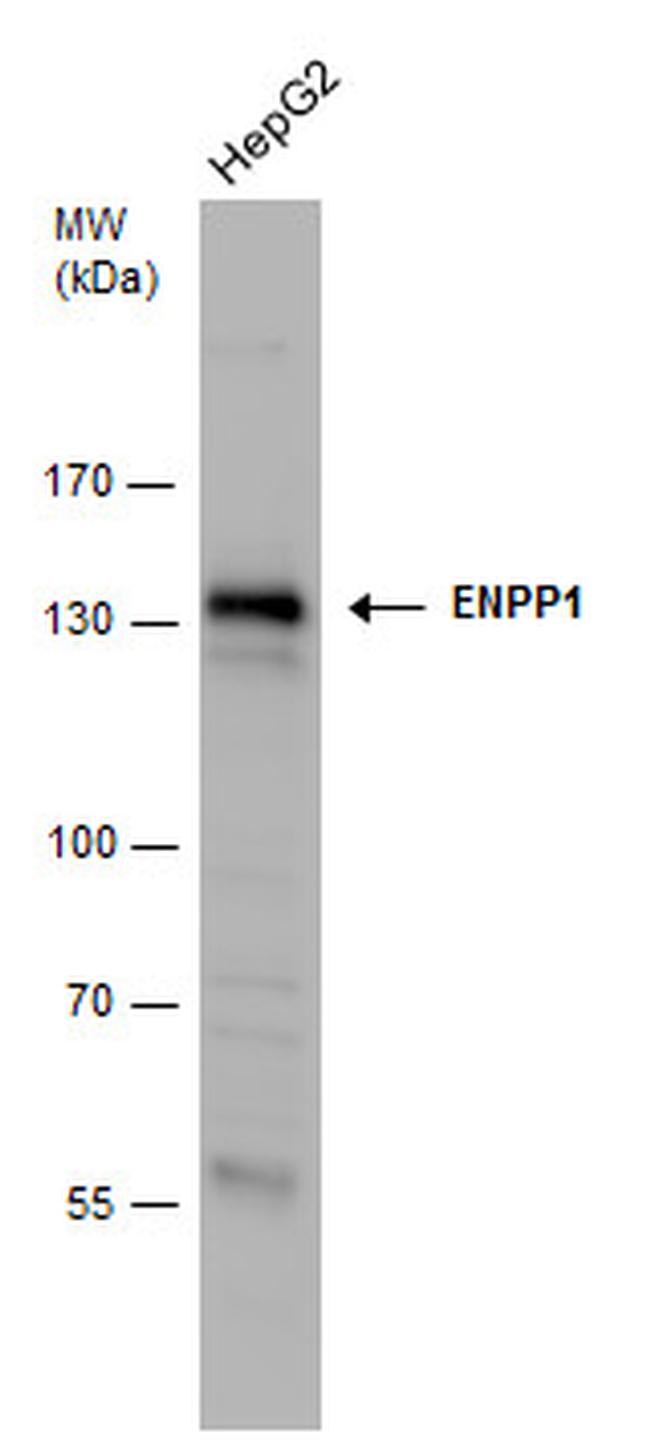 ENPP1 Antibody in Western Blot (WB)
