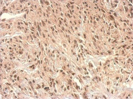 Monoacylglycerol Lipase Antibody in Immunohistochemistry (Paraffin) (IHC (P))