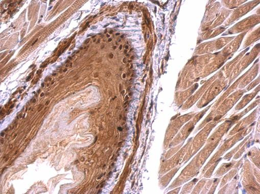 Monoacylglycerol Lipase Antibody in Immunohistochemistry (Paraffin) (IHC (P))