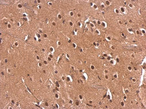 Monoacylglycerol Lipase Antibody in Immunohistochemistry (Paraffin) (IHC (P))