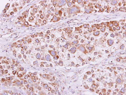 PSKH1 Antibody in Immunohistochemistry (Paraffin) (IHC (P))