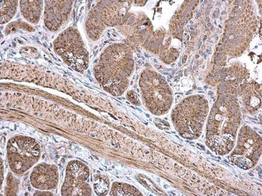 ECH1 Antibody in Immunohistochemistry (Paraffin) (IHC (P))