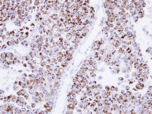 ECH1 Antibody in Immunohistochemistry (Paraffin) (IHC (P))