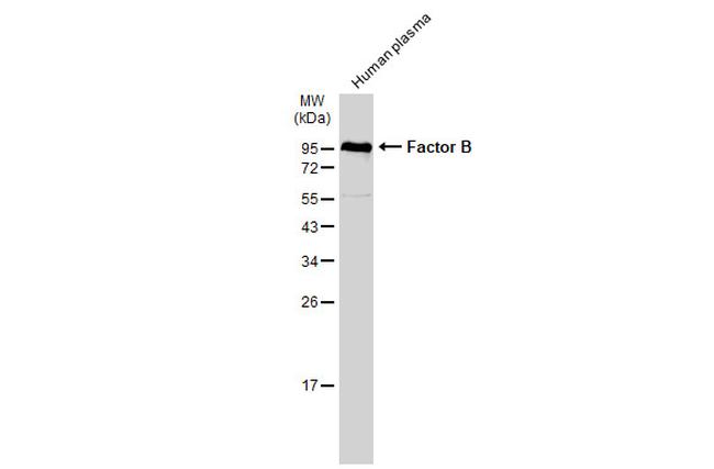 Complement Factor B Antibody in Western Blot (WB)